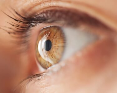 Can cataracts happen in young adults?