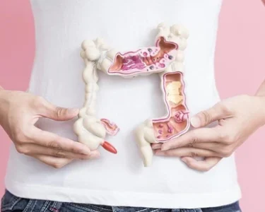 Sharp Increase in Colon Cancer Cases Among Young Adults; Experts Link It to a Common Dietary Habit
