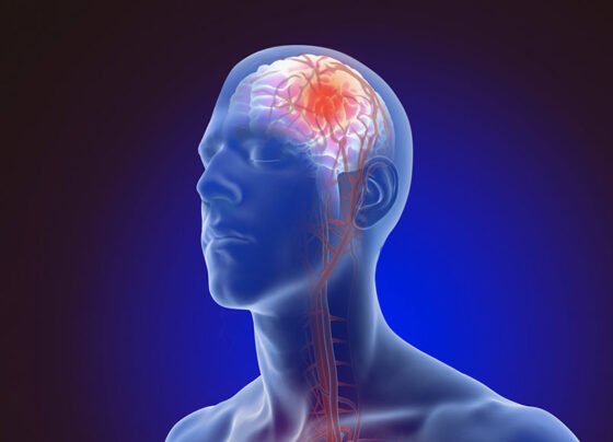 How to spot stroke symptoms early: Act FAST to save a life