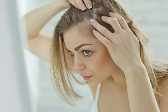 Diabetes Is One of the Major Causes of Hair Loss: Understanding the Effects, Signs, and Symptoms